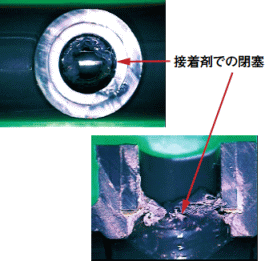 接着剤での閉塞